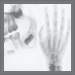 Altersdiagnostik: Röntgenaufnahme des Gebisses im Mahlzahnbereich und eine Röntgenaufnahme der Hand